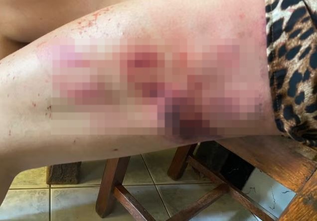 Pai espanca filha com terçado por dívida de R$ 950