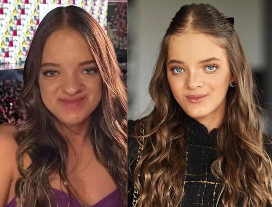 Rafaella Justus rebate críticas por ter feito plástica no nariz aos 14 anos