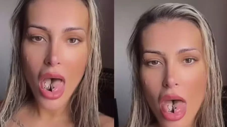 Andressa Urach passa sufoco após cirurgia na língua