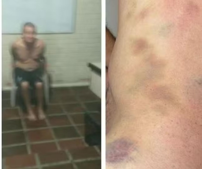 Funcionário de clínica suspeito de torturar paciente até a morte vira réu