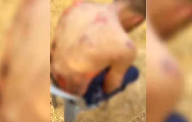 Dono de supermercado e funcionários espancam e ateiam fogo em homem por furto de sandália 