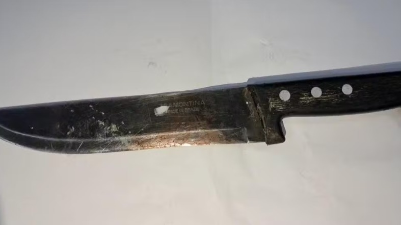 Mulher corta pênis do marido por falhar na hora 'H' em Rondônia