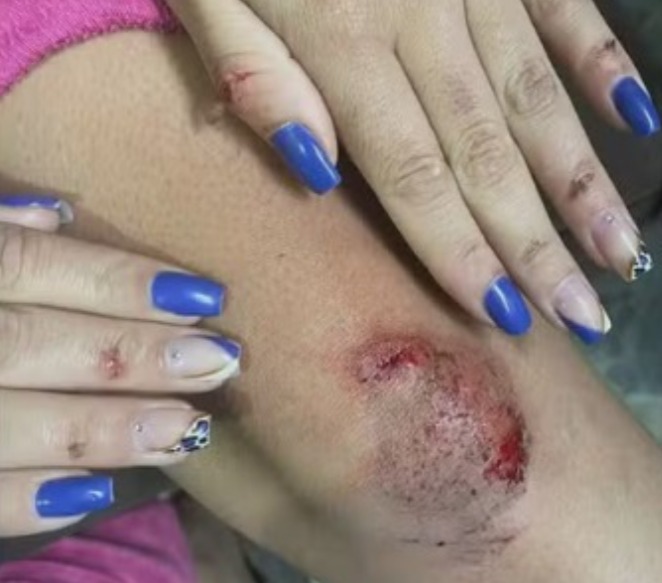 Jovem pula de carro em movimento após ser assediada por motorista de app