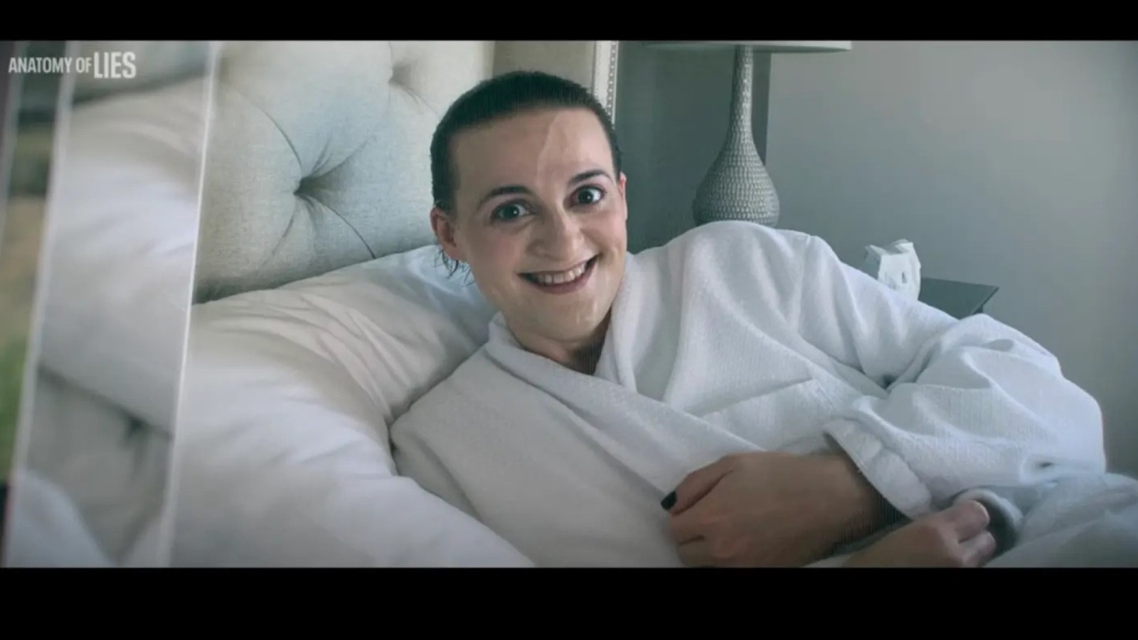 Roteirista de 'Grey's Anatomy' raspava a cabeça para fingir que tinha câncer