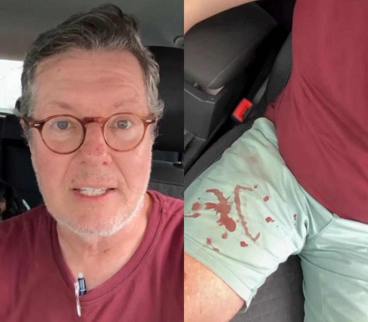 Âncora da CNN, Márcio Gomes, fica ferido em tentativa de assalto