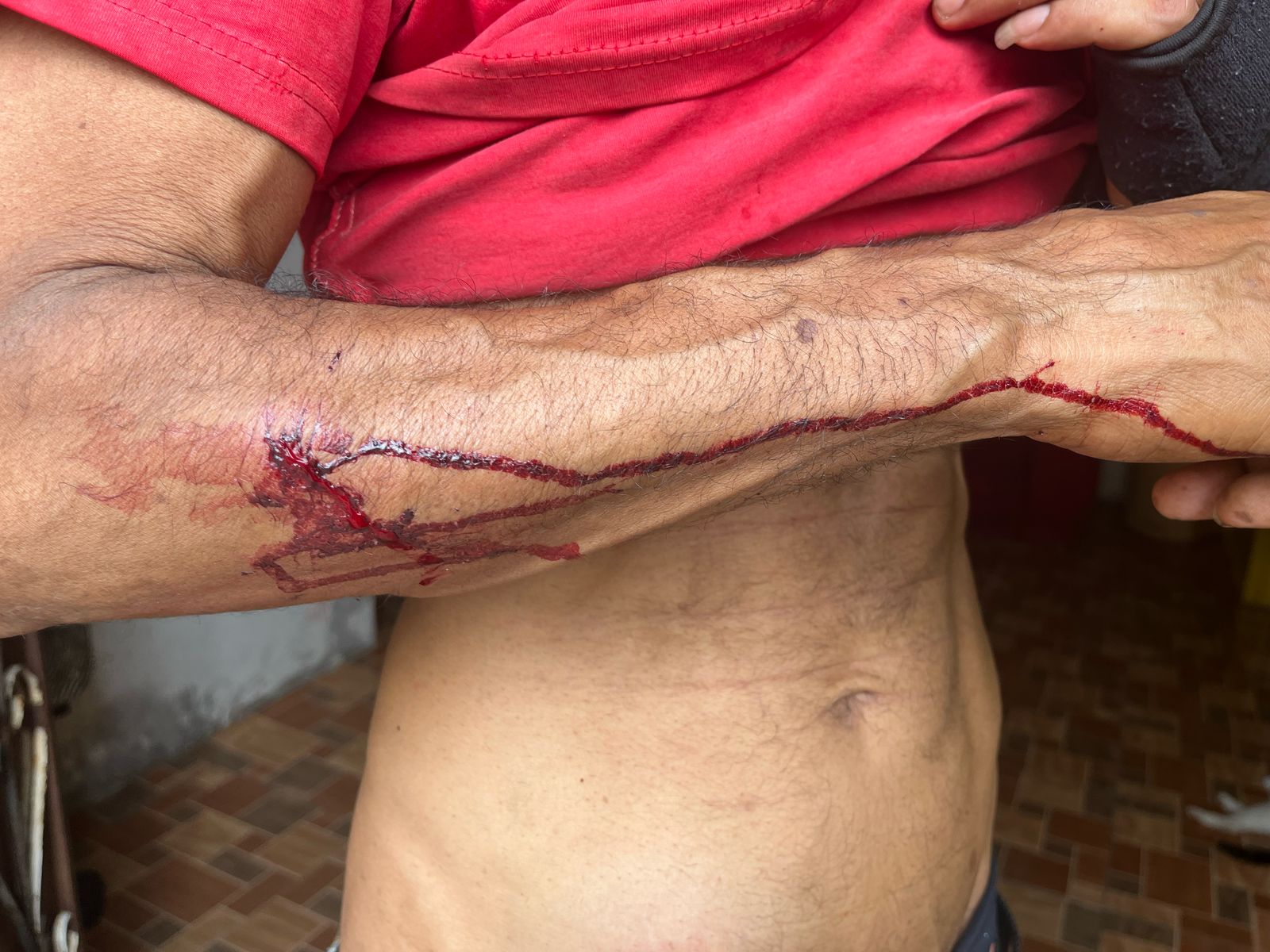 Morador denuncia ação de PM após ser baleado no Santa Etelvina