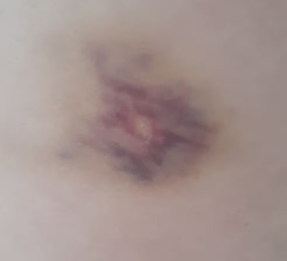 Professora é agredida a socos e ameaçada por aluna no Tocantins