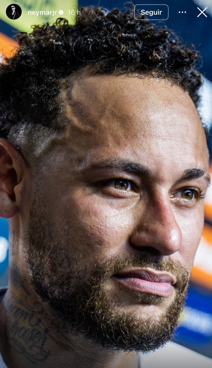 Neymar faz desabafo ao mostrar ferimento e reclama de arbitragem 