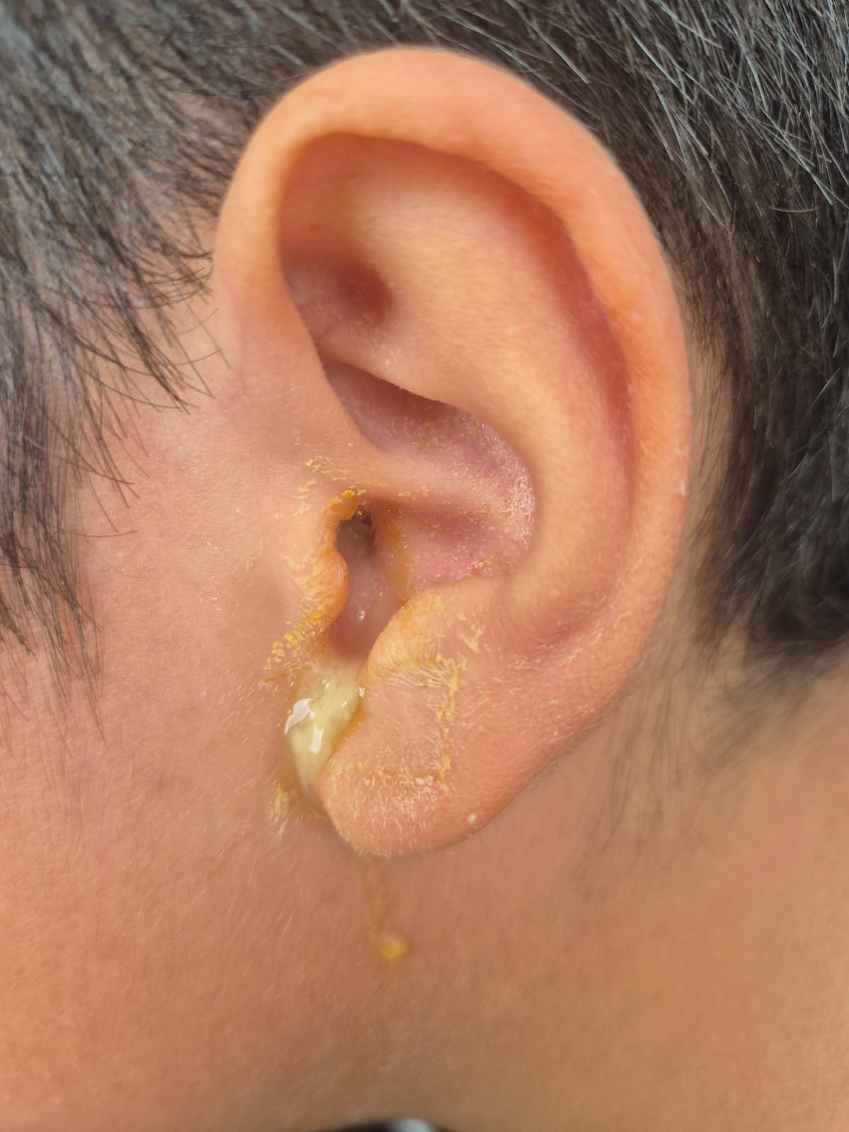 Servidor do TJAM é suspeito de perfurar tímpano de menino de 8 anos em Manaus