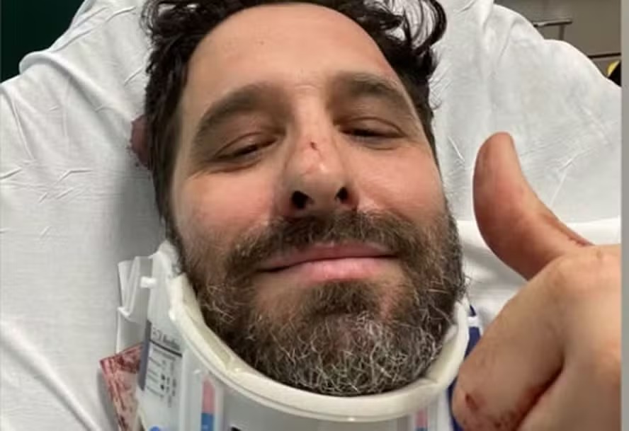 Rafinha Bastos sofre acidente em Nova York