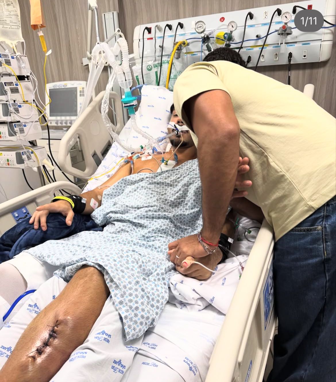 Influencer Vittor Fernandes deixa UTI após ser baleado: ‘estilhaçou e foi parar dentro do coração’