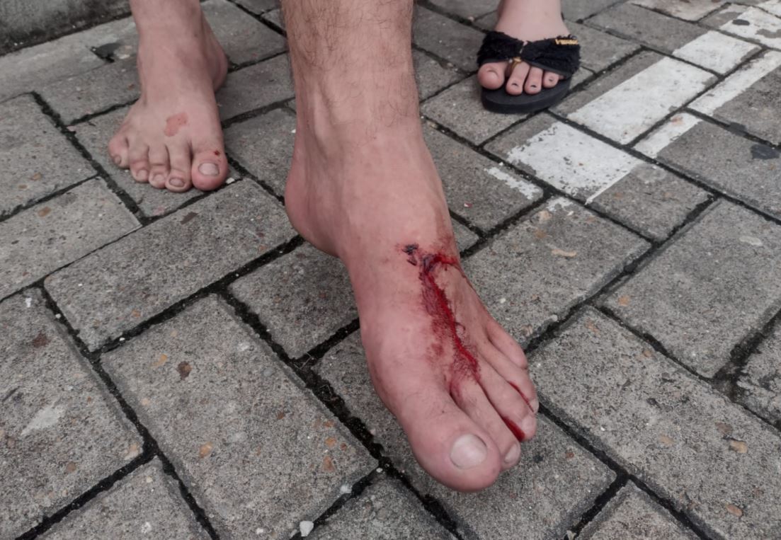 Mãe aplicou mata-leão em homem que invadiu casa e tentou estuprar criança em Manaus