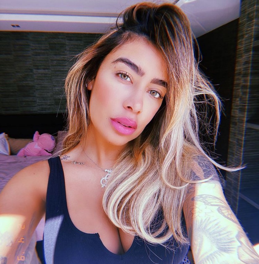 Rafaella Santos faz novos procedimento estéticos no rosto; veja mudança