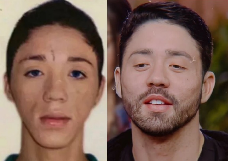 Antes e depois de Rico, de A Fazenda, choca internautas; ele gastou R$ 70 mil