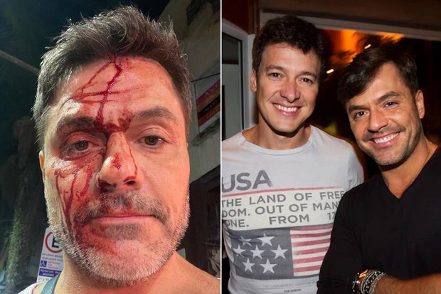 Irmão de Rodrigo Faro sofre acidente grave de carro em São Paulo 