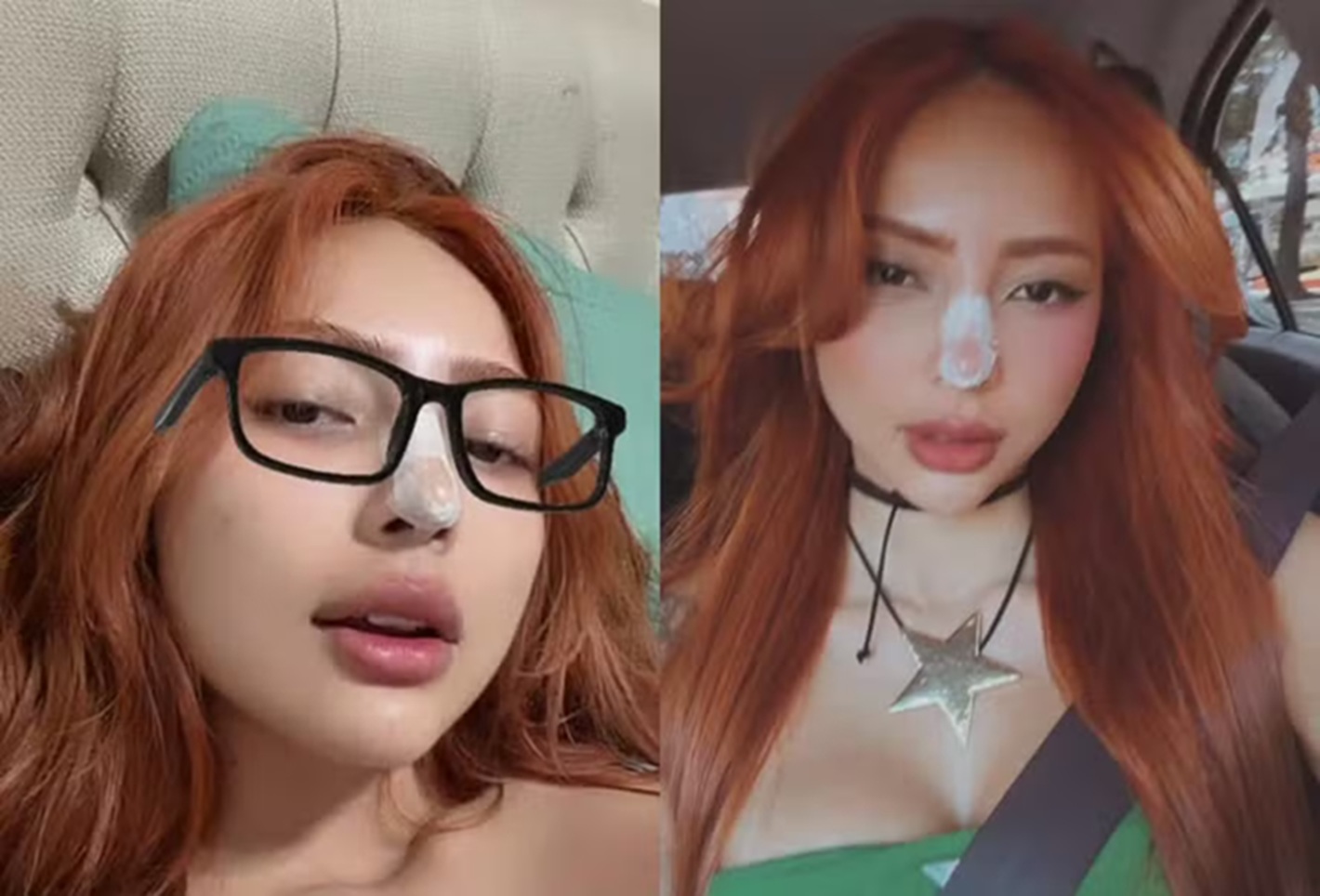 Ruivinha de Marte muda nariz e comenta resultado de procedimentos