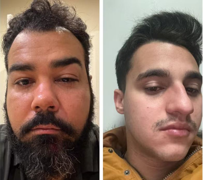 Irlandeses agridem brasileiros a socos e divulgam vídeos no Tik Tok