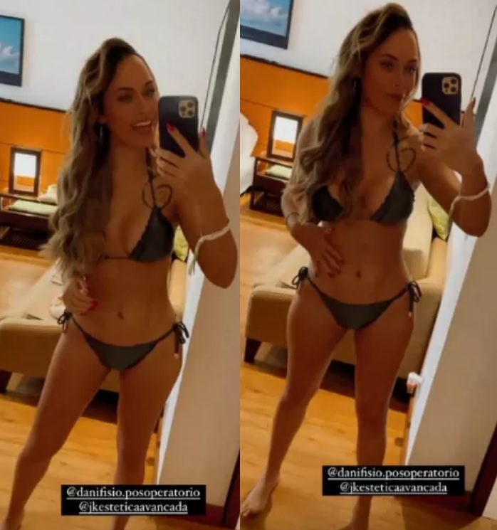 Ex-BBB Sarah mostra corpo 22 dias após lipo LAD e silicone