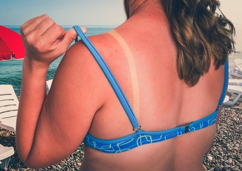 Filtro solar deve ser usado inclusive no inverno para evitar câncer de pele