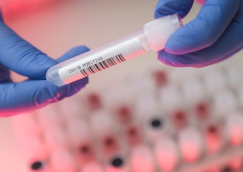 Sobe para 247 os casos suspeitos de reinfecções por coronavírus no Brasil