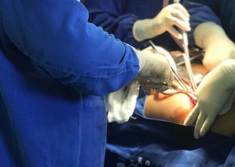 Diagnóstico precoce de câncer evita amputação de pênis de pacientes