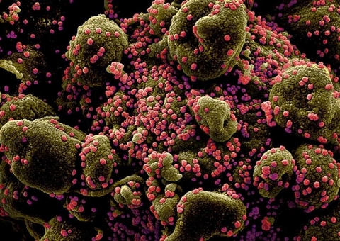 Estudo afirma que anticorpos contra coronavírus diminuem com o tempo