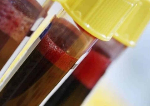 Cientistas descobrem que tipo sanguíneo é menos vulnerável ao coronavírus