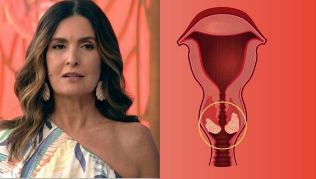 Vacina do HPV pode evitar câncer de útero detectado em Fátima Bernardes