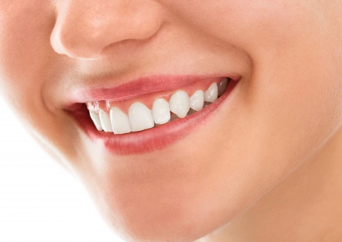 É seguro usar lentes de contato dental? Especialista explica 