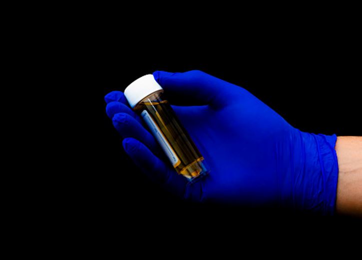 Cinco novos casos de rabdomiólise são registrados no Amazonas