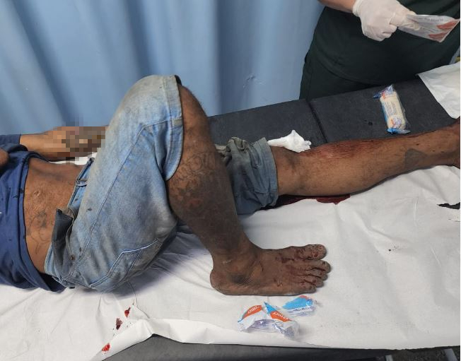 Homem é baleado e espancado com barra de ferro em feira de Manaus