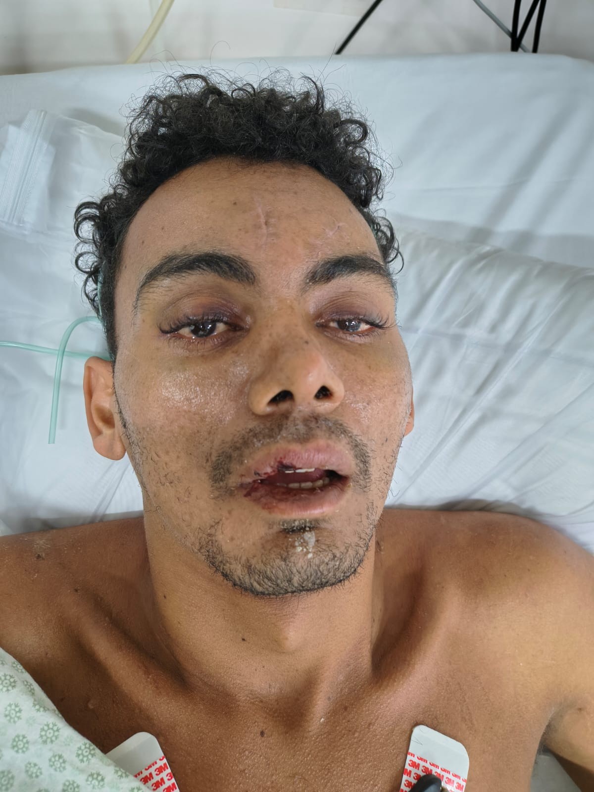 Hospital busca família de paciente internado após cair de 5 metros de altura em Manaus