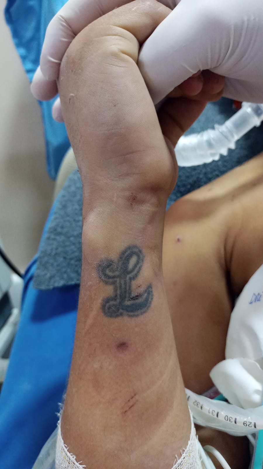 Hospital procura família de homem internado vítima de acidente em Manaus