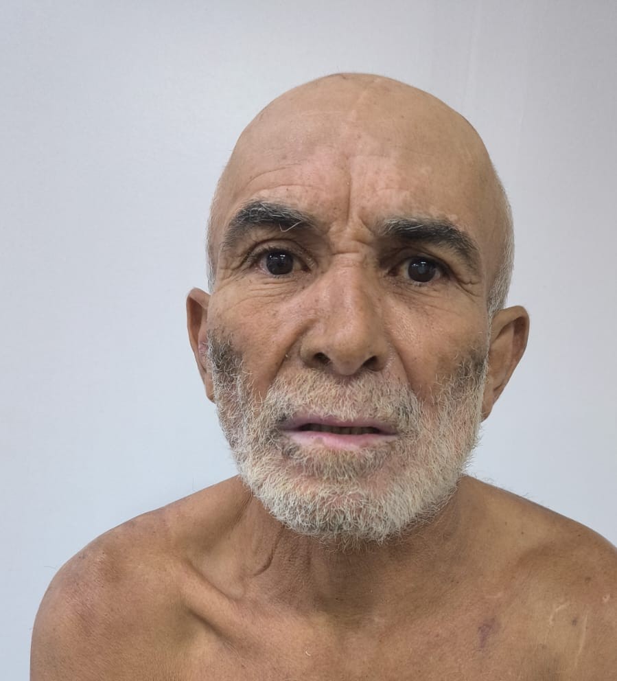 Hospital busca familiares de venezuelano vítima de agressão em Manaus