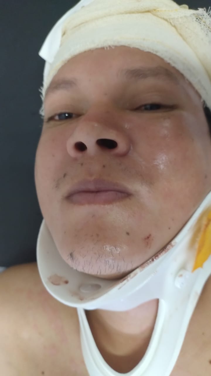 Hospital procura família de paciente atropelado em Manaus