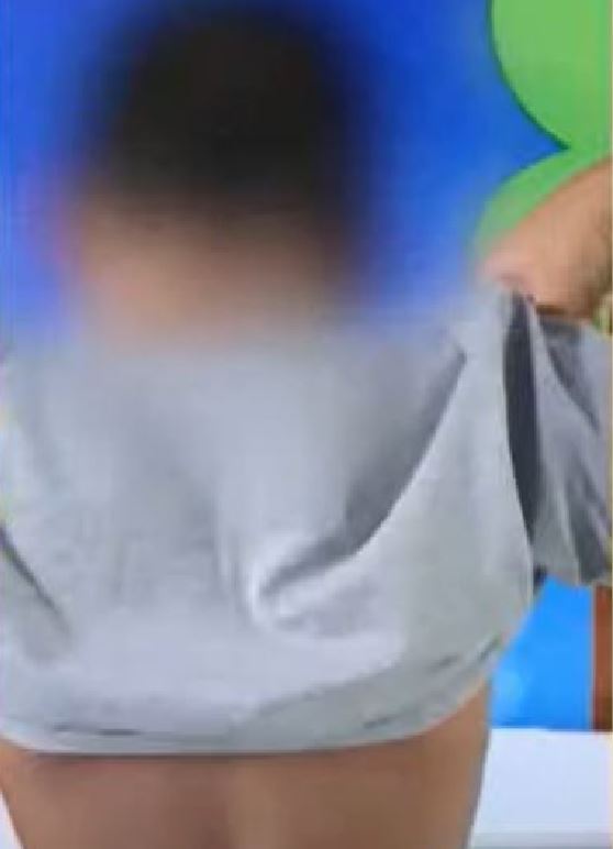 Menino de 8 anos que era espancado pelo pai é resgatado em Manaus