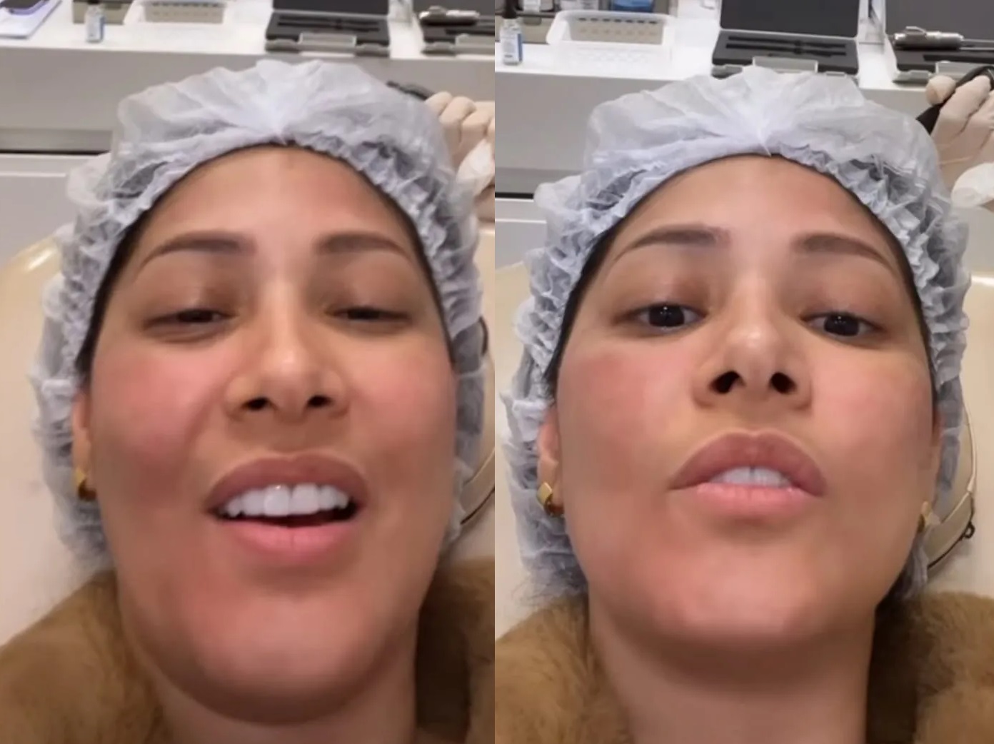 Simaria faz procedimento para retirar papada: ‘cansei de tanta feiura’