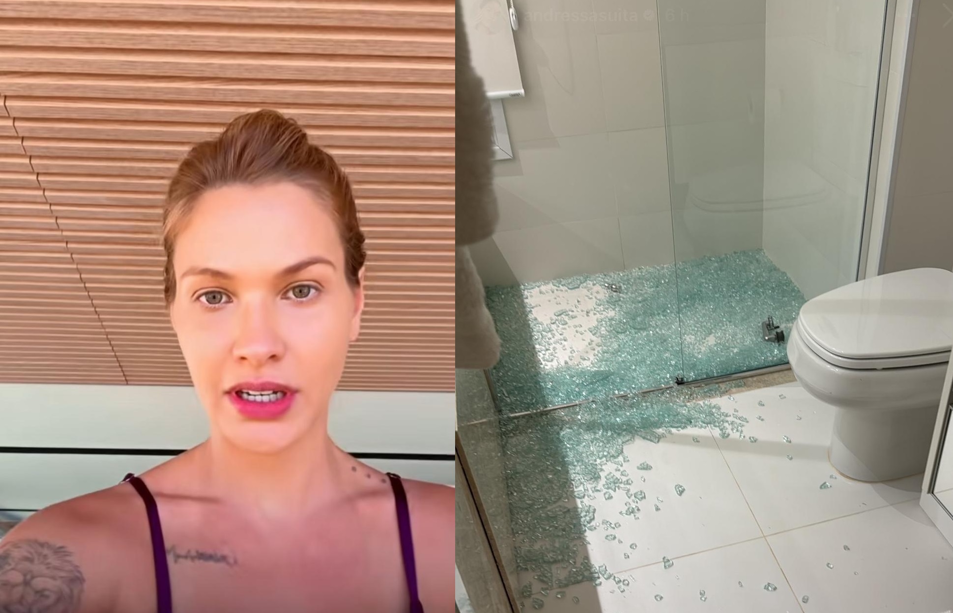 Andressa Suita sofre acidente doméstico: "não parava de sangrar"