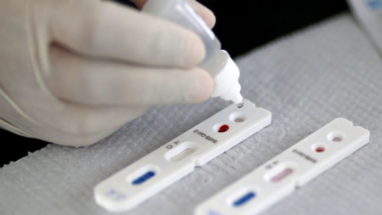 Teste de Covid pode ser declarado no Imposto de Renda 2021