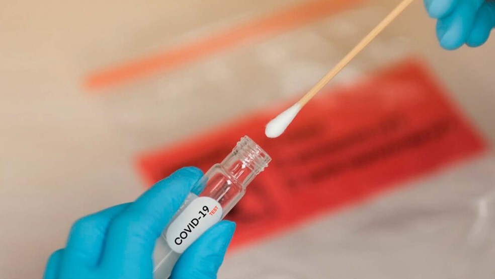 Covid-19: país tem 22,1 milhões de casos e 615,5 mil mortes