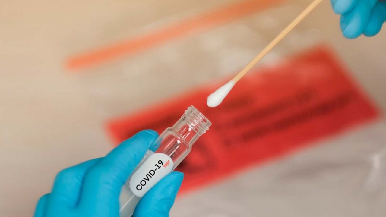 Brasil registra 2.978 novos casos de covid-19 e 34 mortes