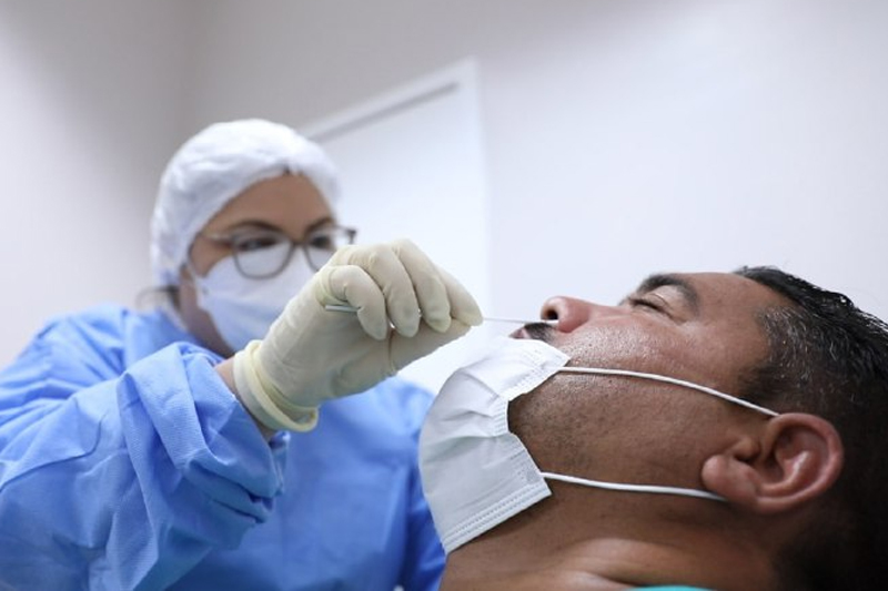 Covid-19 é a causa de 71% de Síndrome Respiratória Aguda Grave no Amazonas