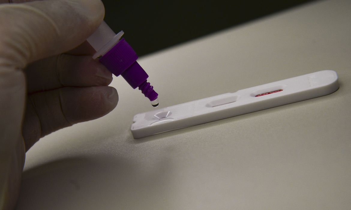 Fiocruz: casos de síndrome respiratória grave atingem patamar estável