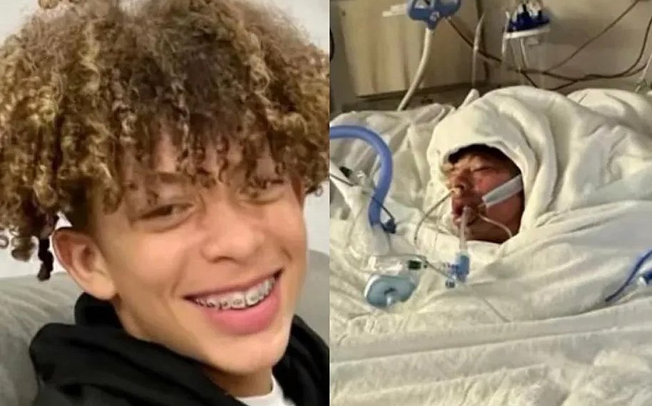 Tiktoker de 16 anos tem 80% do corpo queimado ao tentar fazer desafio