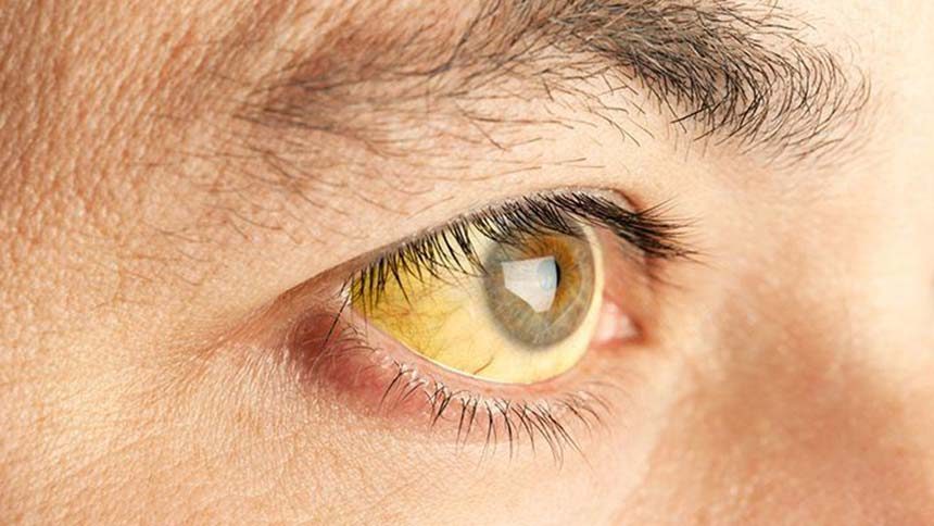 Casos de hepatite têm redução de 54% no Amazonas