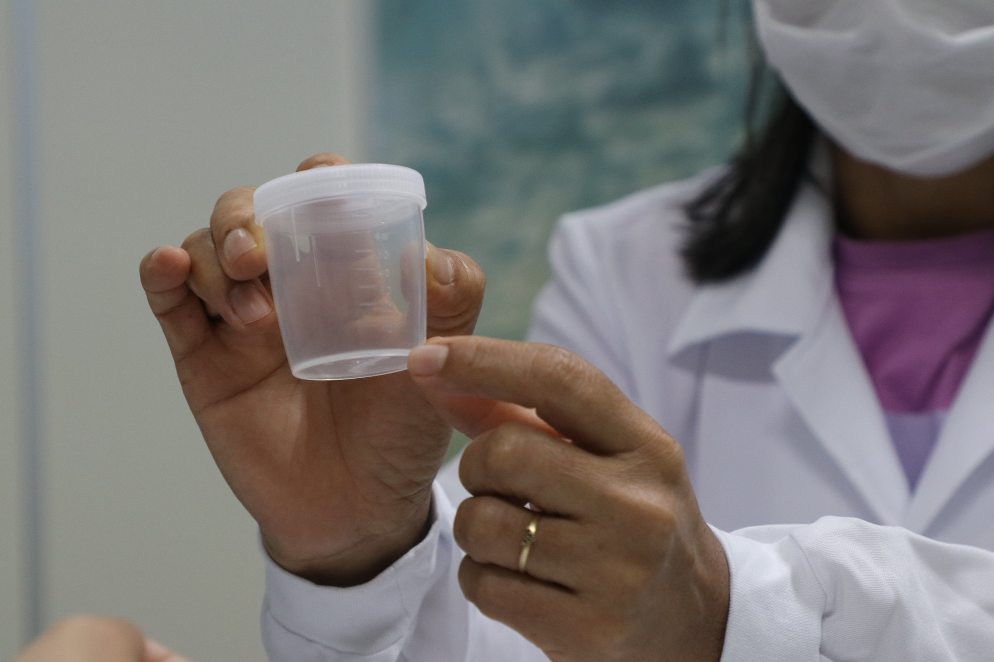 Amazonas ocupa 1º lugar em casos de Tuberculose no brasil e FVS faz alerta