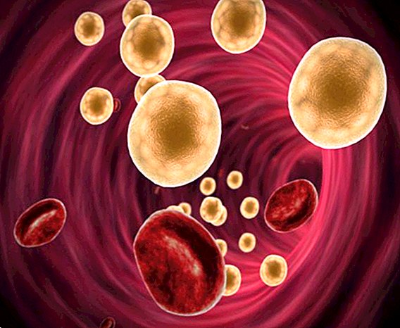 Gordura no sangue: conheça características da doença