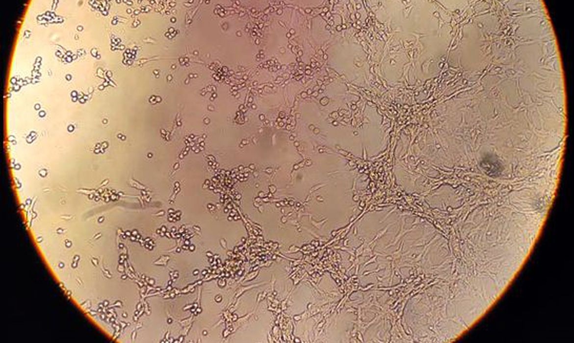 São Paulo confirma segunda morte causado pela varíola dos macacos