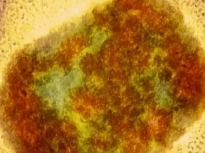 Varíola dos macacos tem risco iminente de chegar ao Brasil, diz cientista