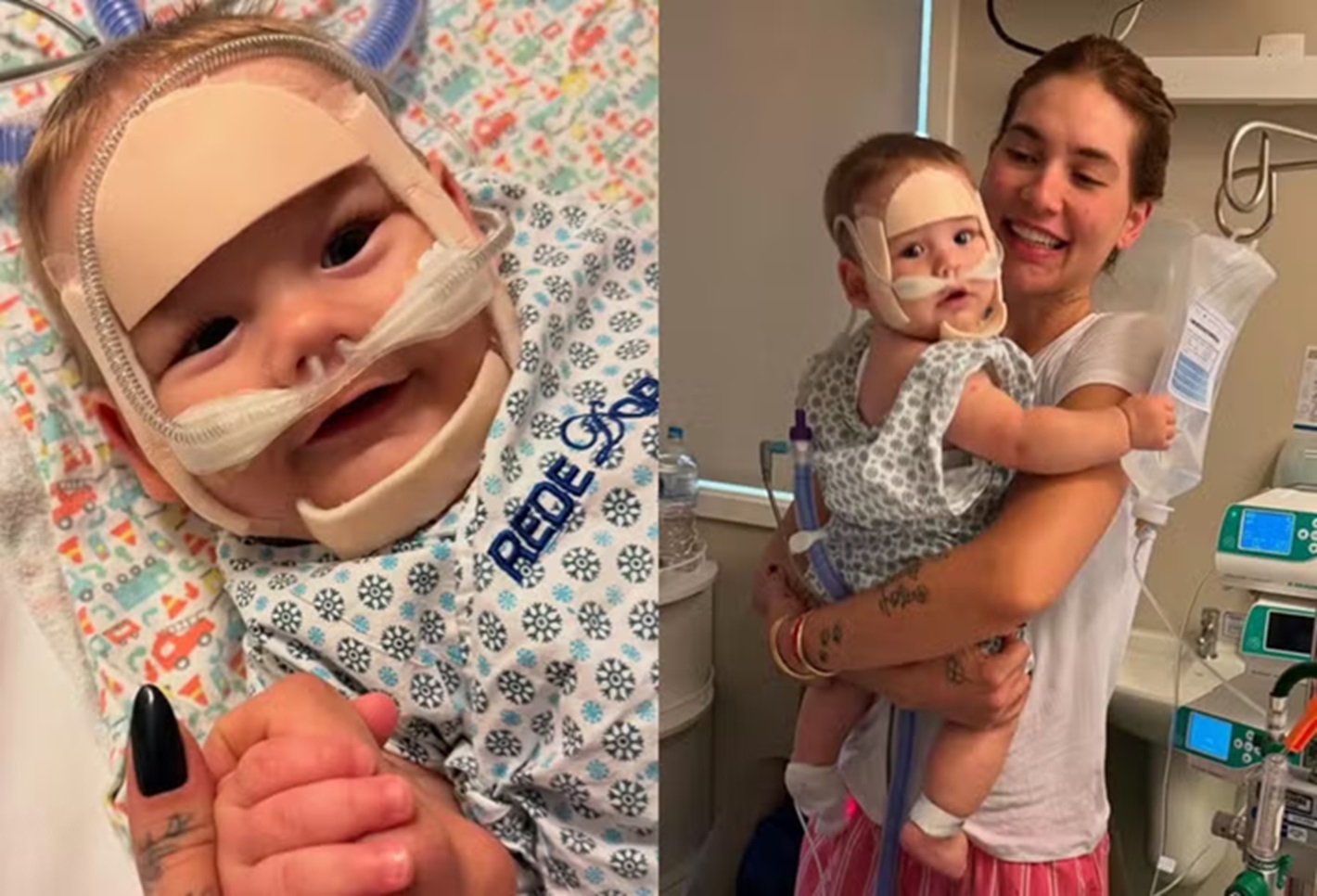 Bebê de Virgínia segue na UTI, mas apresenta melhora